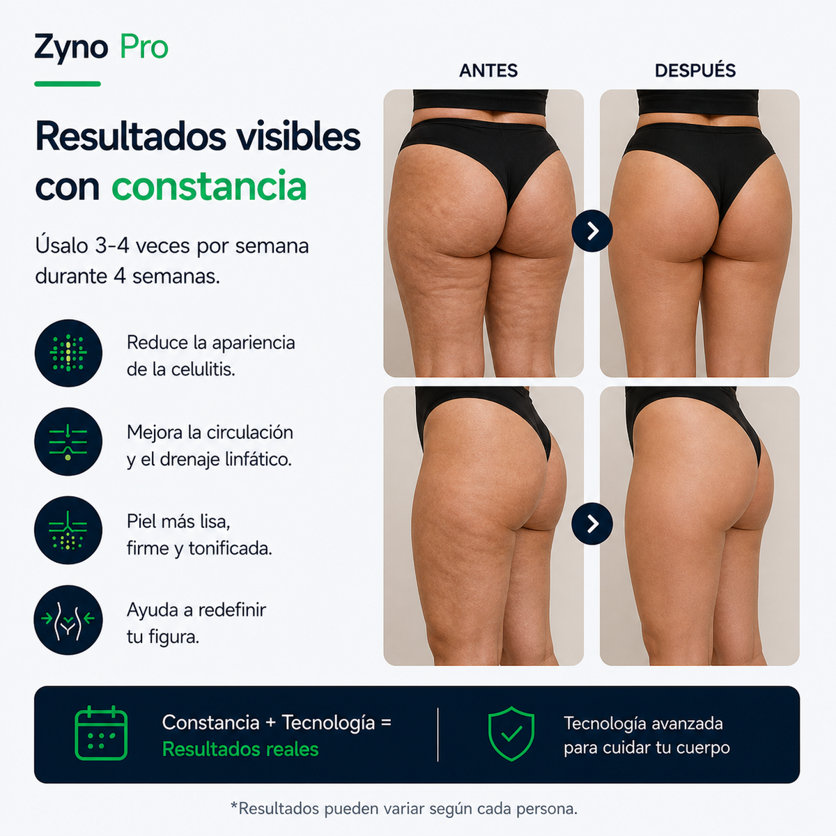 Zyno Pro - Tu Aliado Anticelulitis