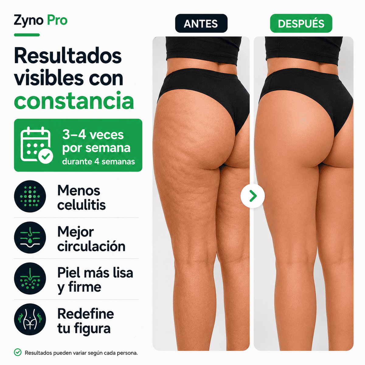 ZynoPro - La solución a la Celulitis